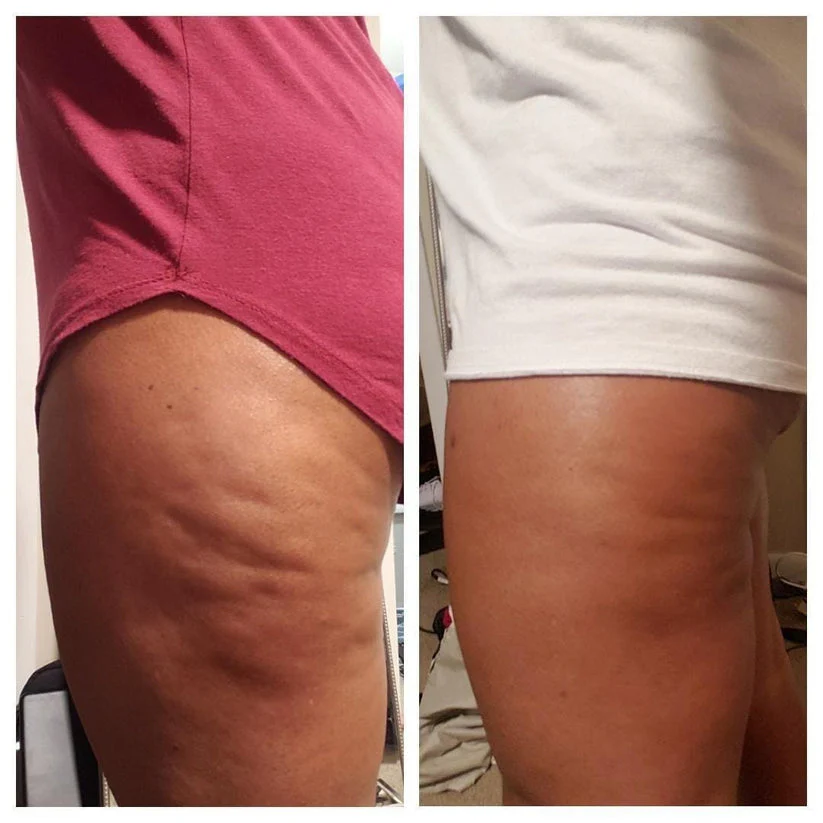 Silk Anti-Cellulite Oil with Collagen for Smoother, Firmer Skin